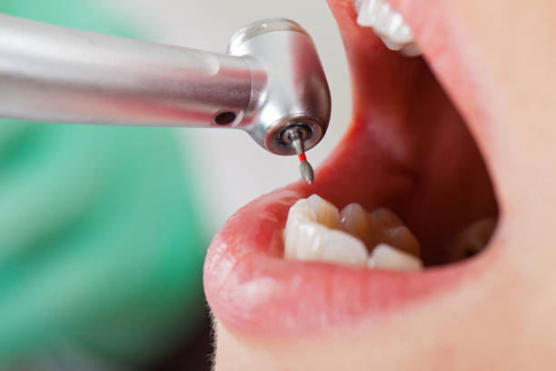 Best Weekend Emergency Dentist in Murray, KY